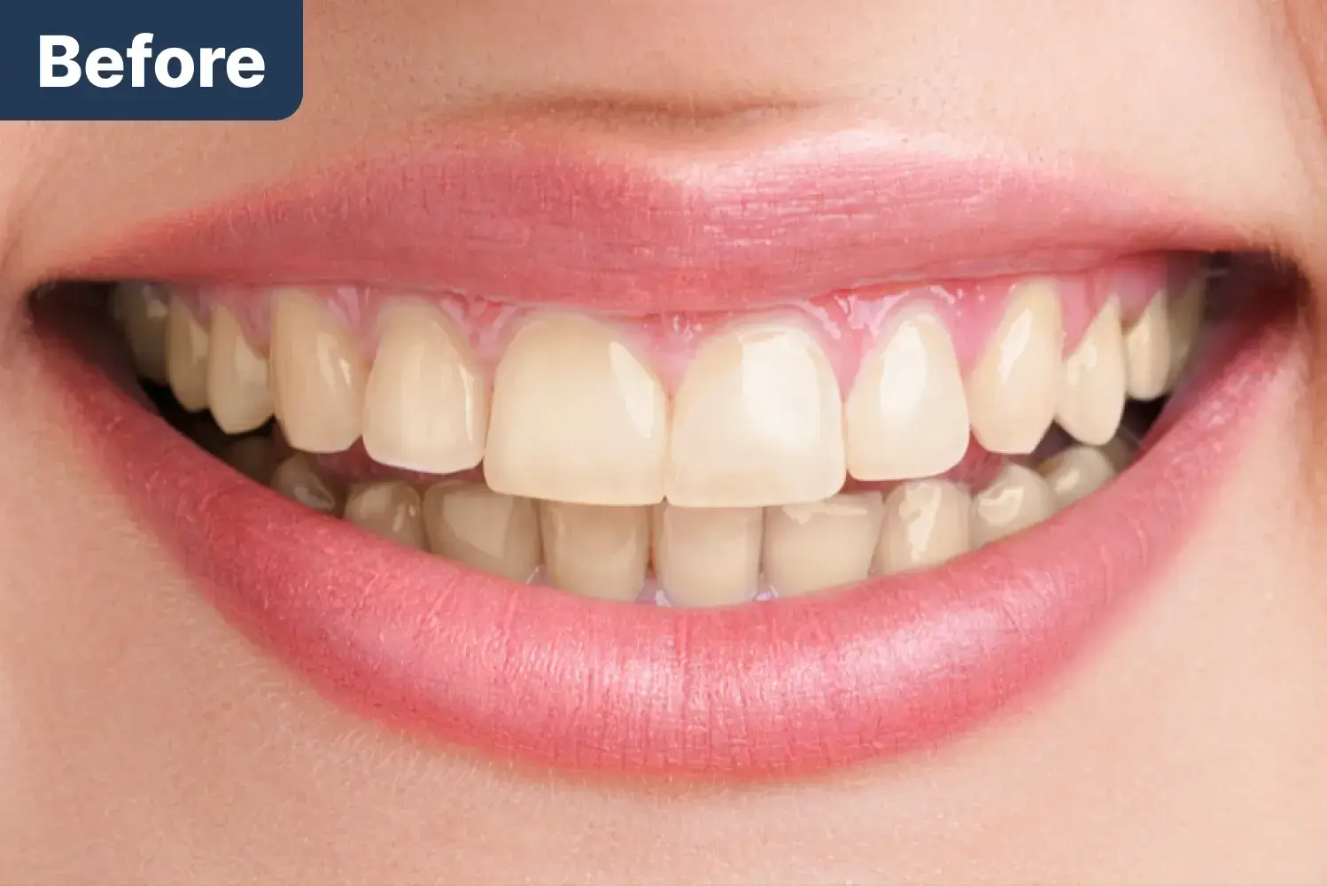 Before Dynamic Dental