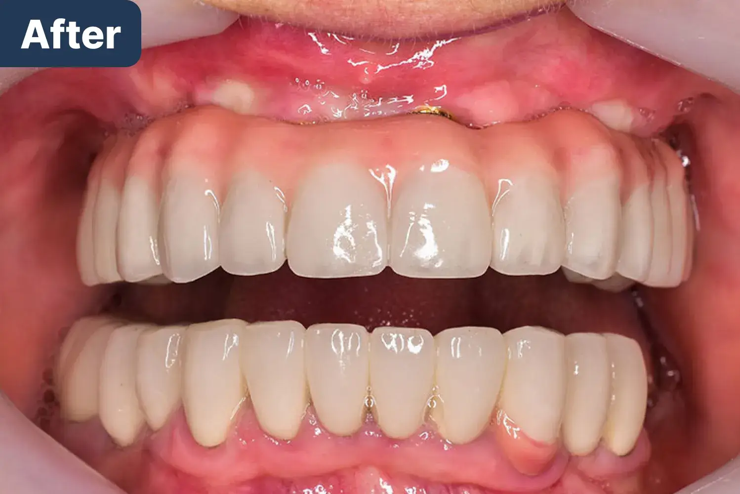 Mouth After Dynamic Dental