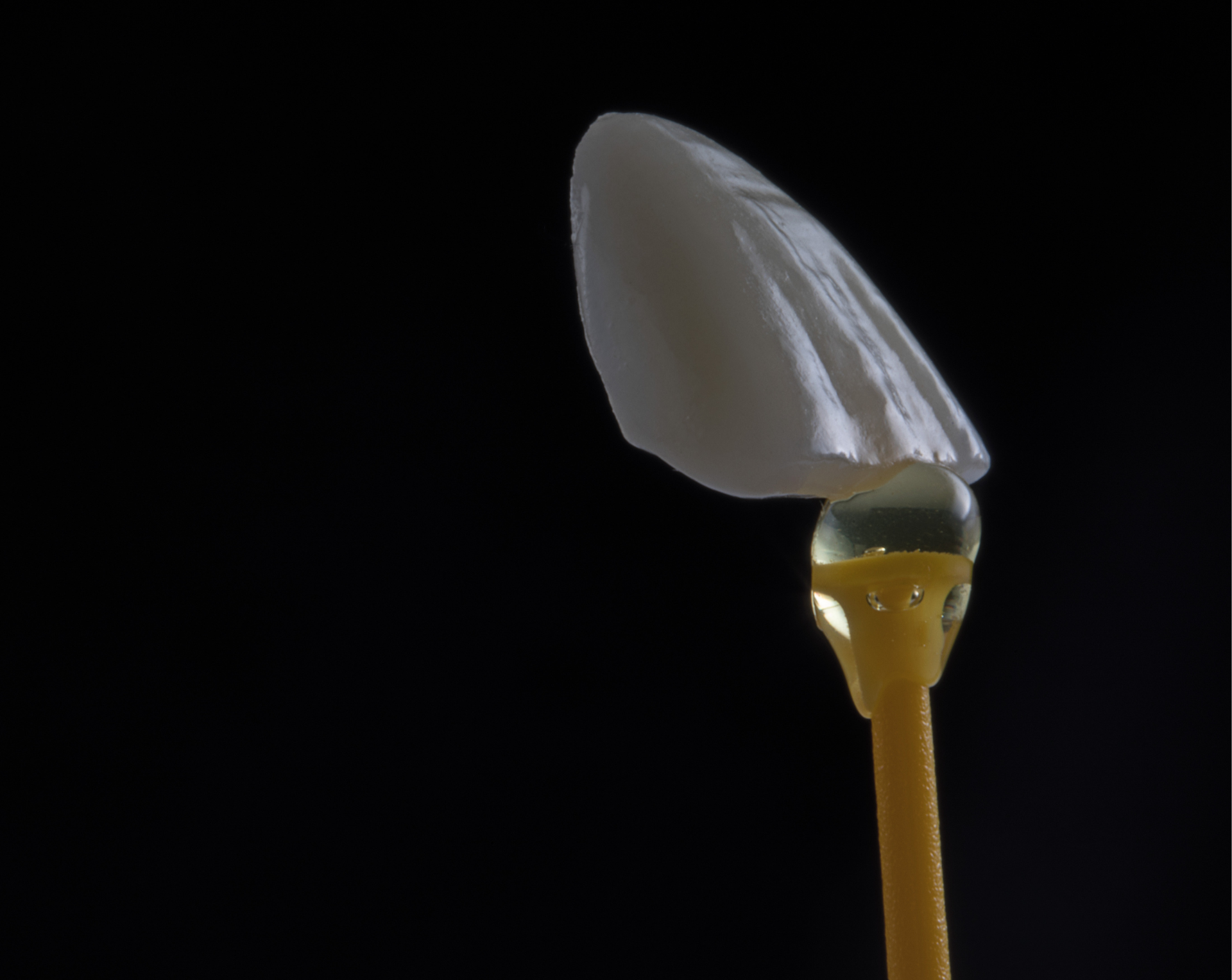 Facettes dentaires : corrigez votre sourire sans chirurgie