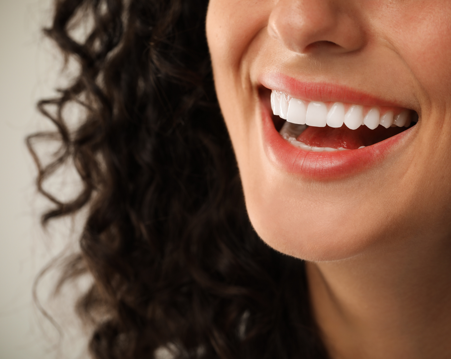 Sourire d’une femme après la pose de facettes dentaires en porcelaine, illustrant un résultat esthétique naturel et harmonieux.