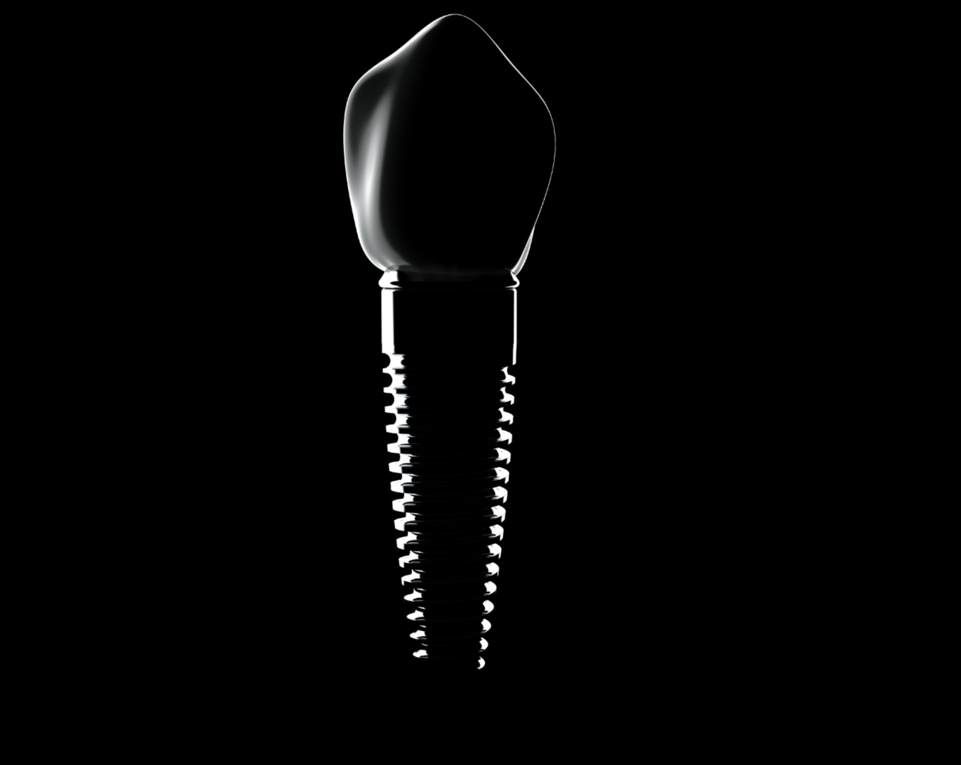 Implant dentaire : solution durable pour remplacer une dent