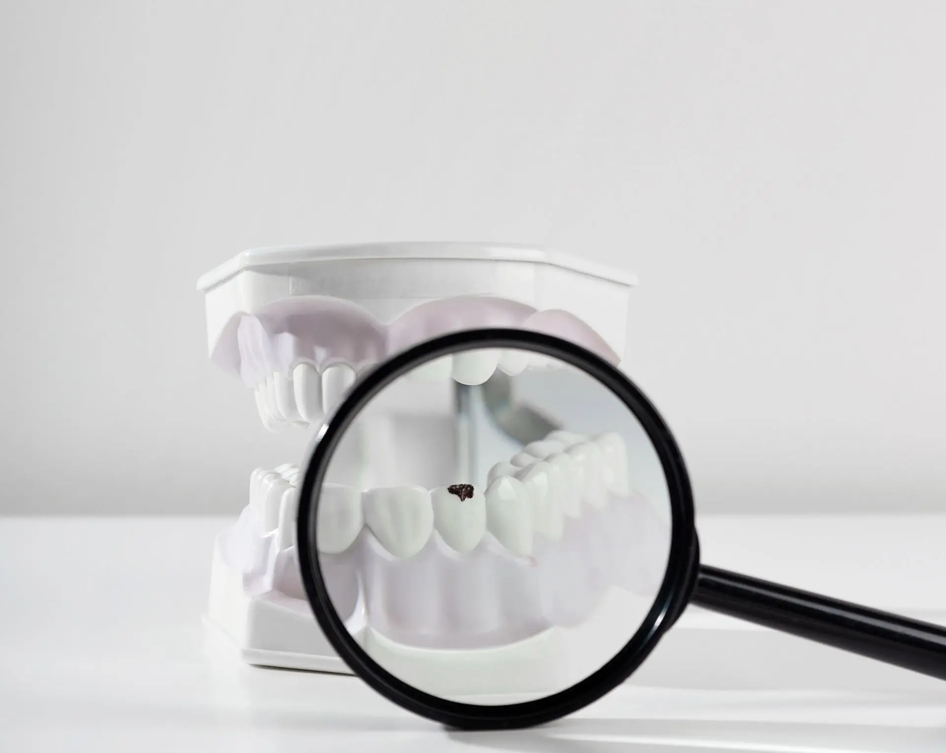 Obturations dentaires