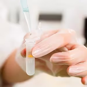 What to Consider in Designing a Protein Purification Buffer