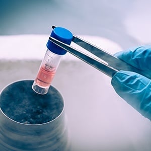 An Overview of Subcellular Fractionation