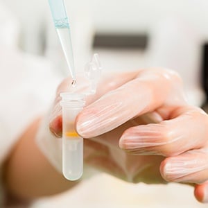 What to Consider in Designing a Protein Purification Buffer