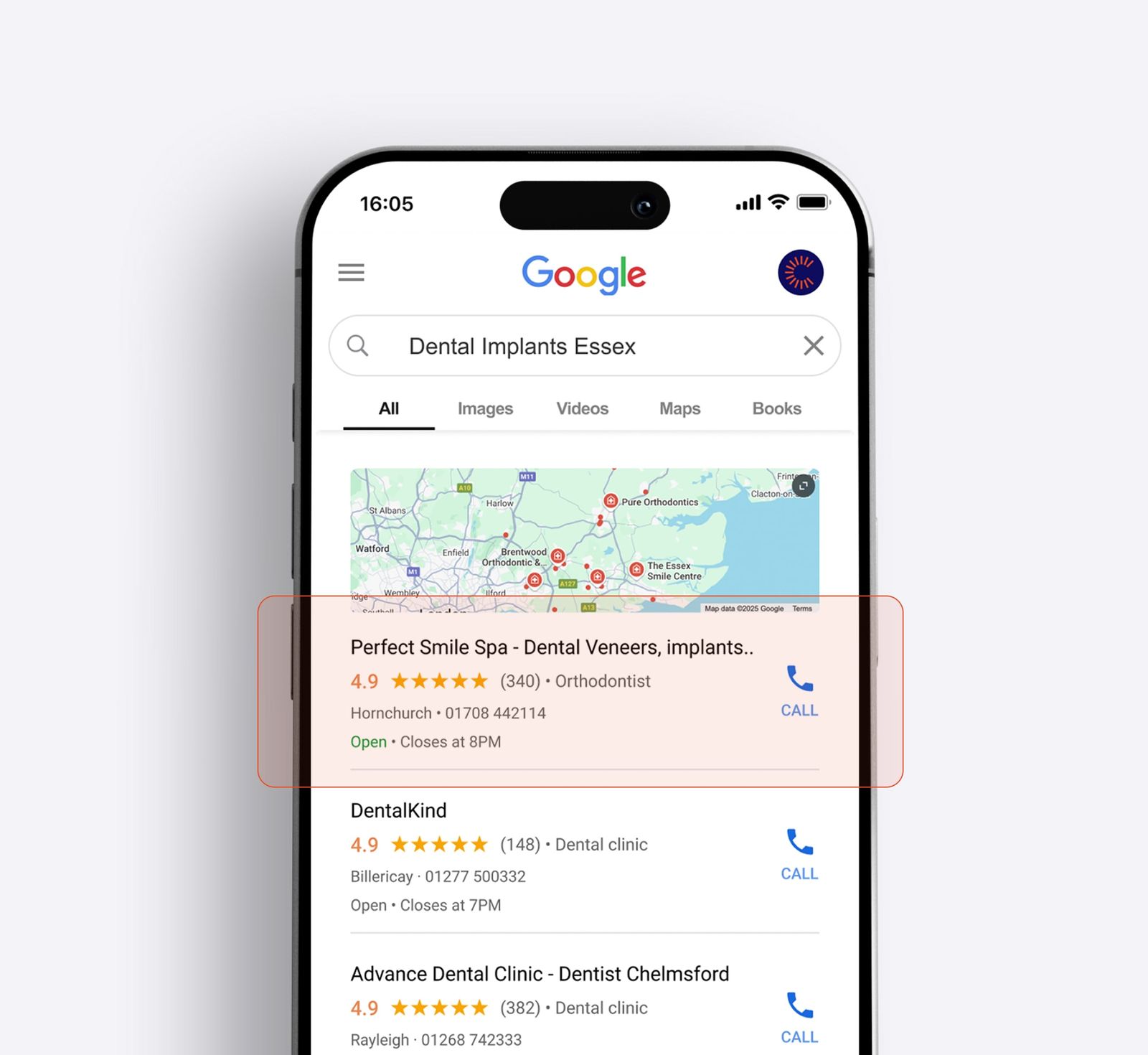 Local SEO for dental practice