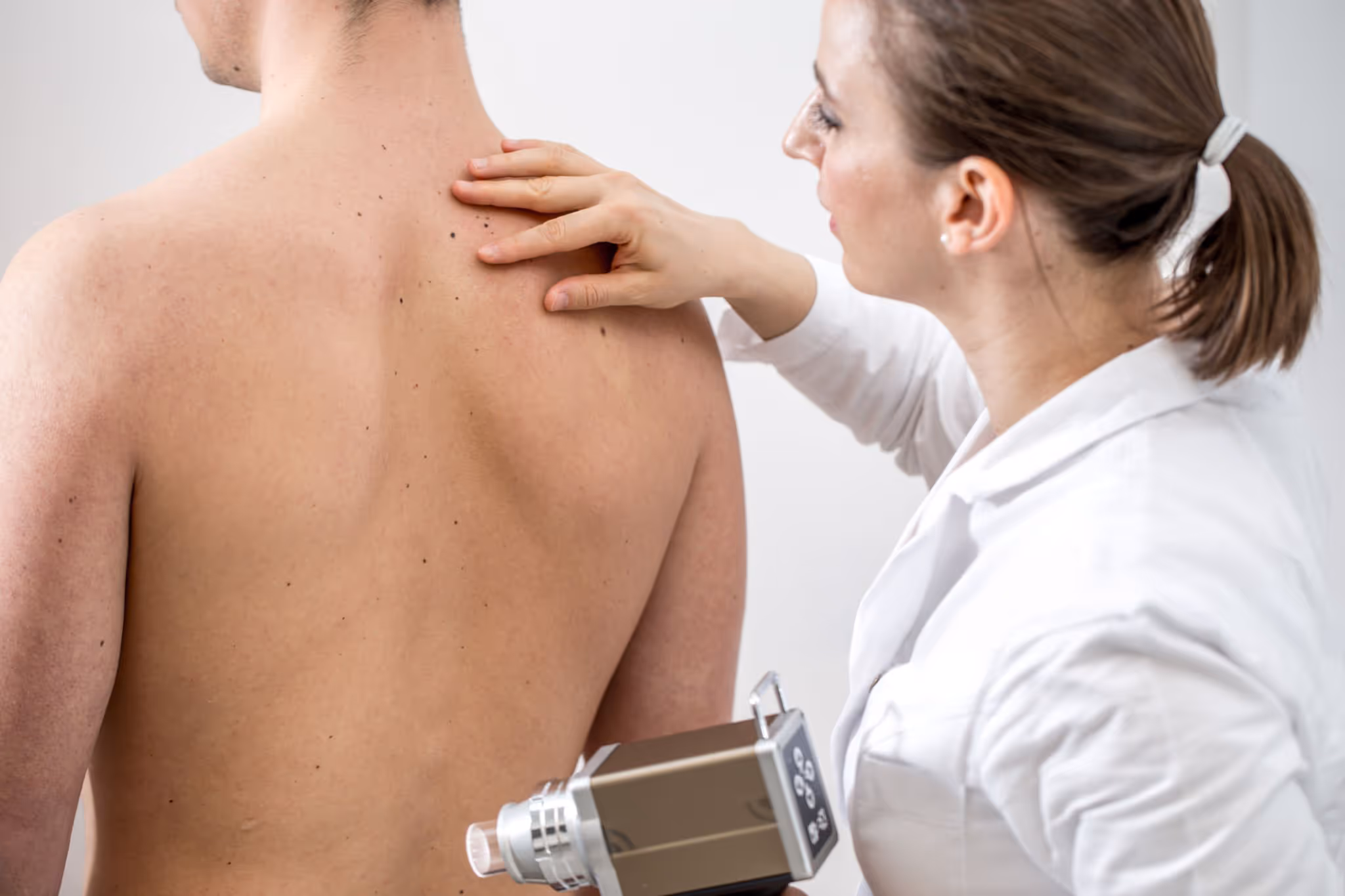 SWIFT Wart Treatment