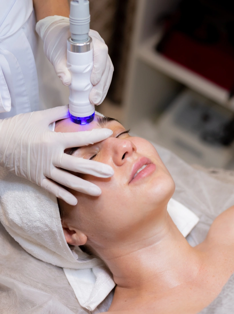 Laser Treatment