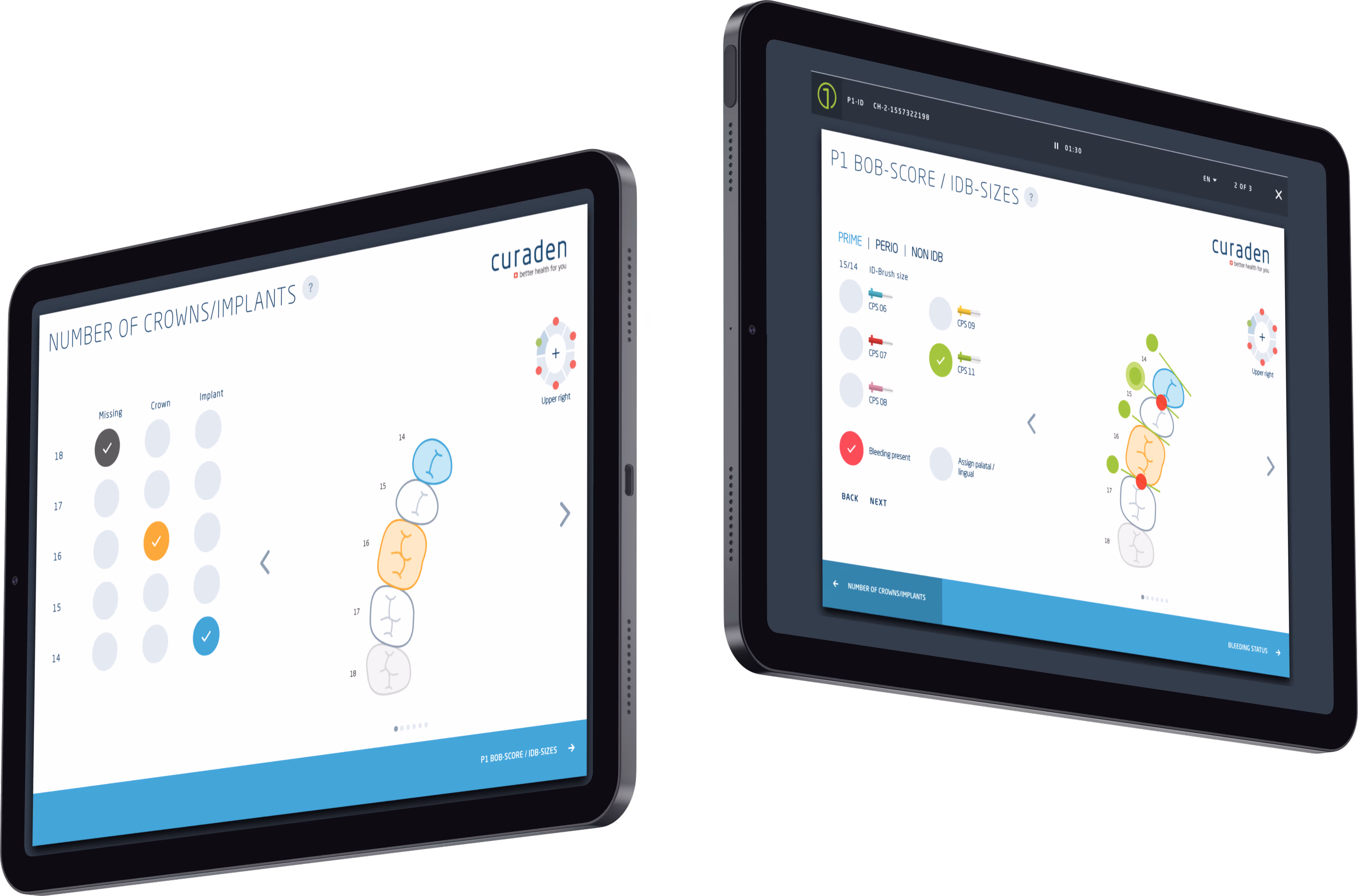 Two tablets displaying a dental health app interface with teeth diagrams and options for crowns, implants, and bleeding status.