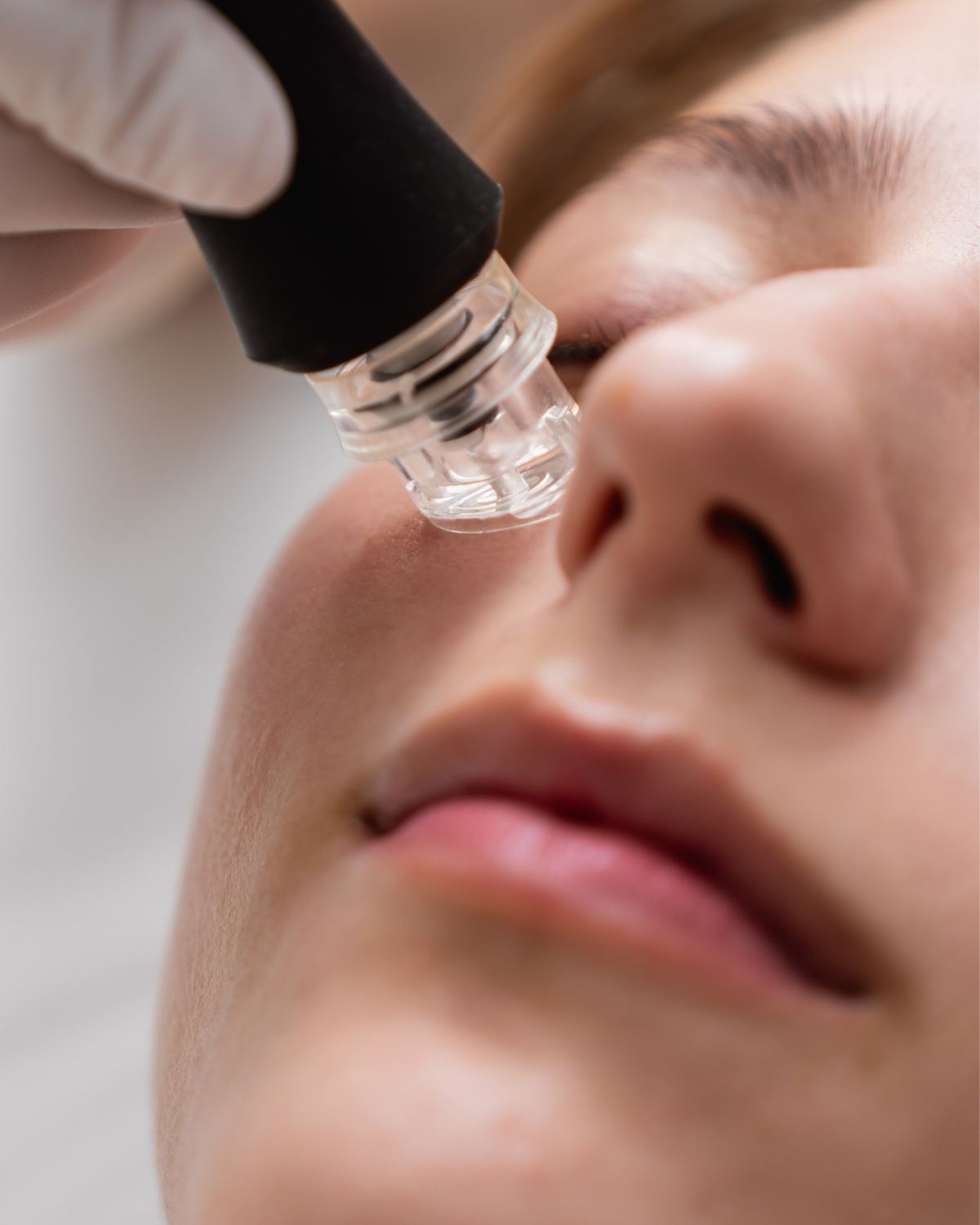 Aqua Facial – Tiefenreinigung, Feuchtigkeit & Glow