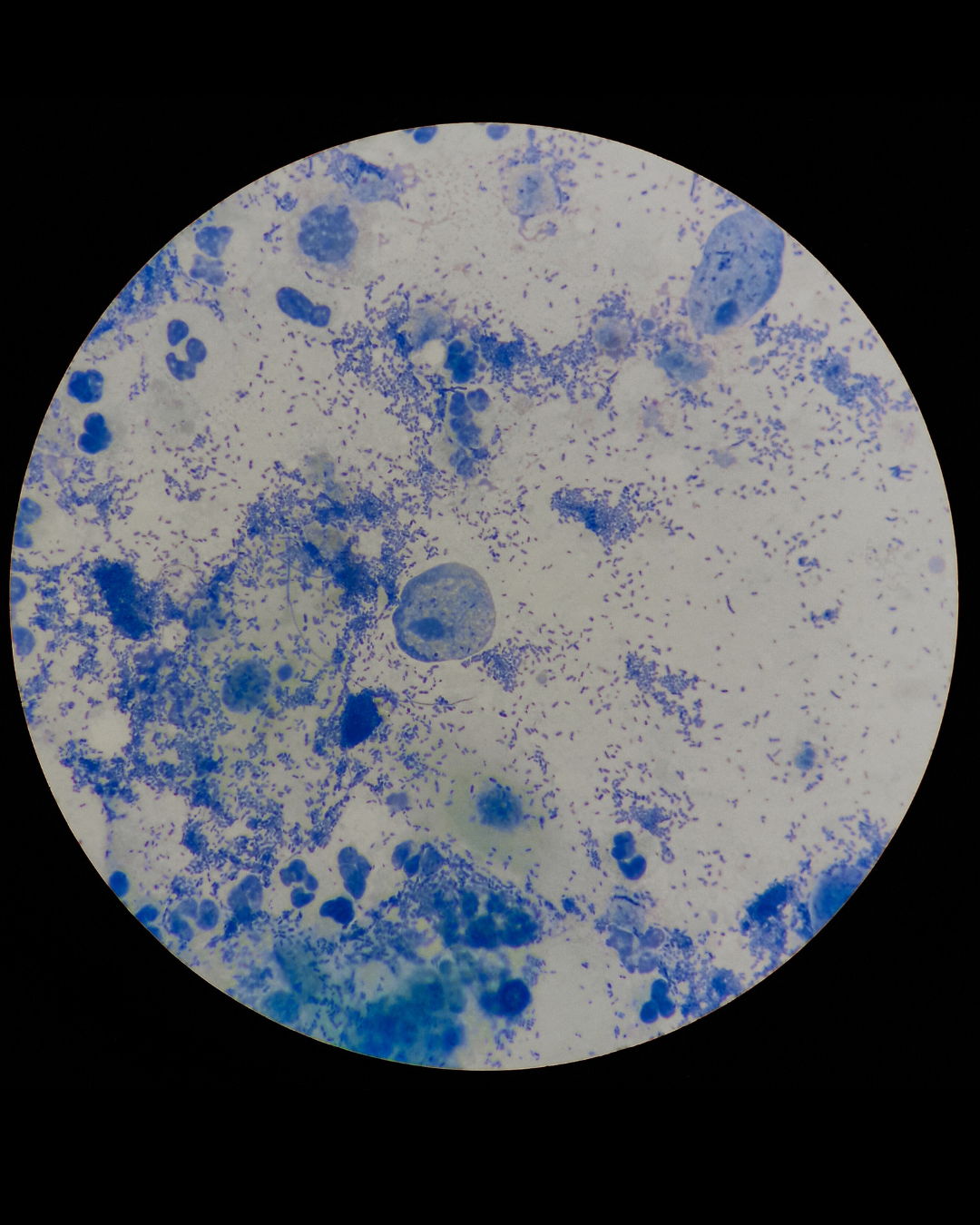 Biomarker analysis reveals how to improve cellular energy and slow aging