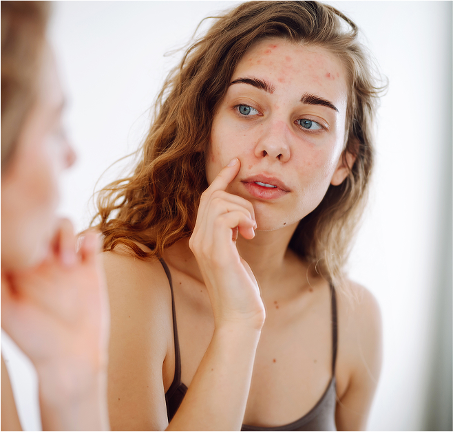 Woman looking at skin blemishes