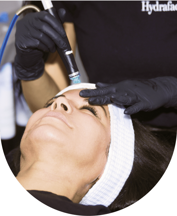 HydraFacial in progress at FYX SKIN in Brea, California