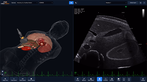 virtual ultrasound simulator