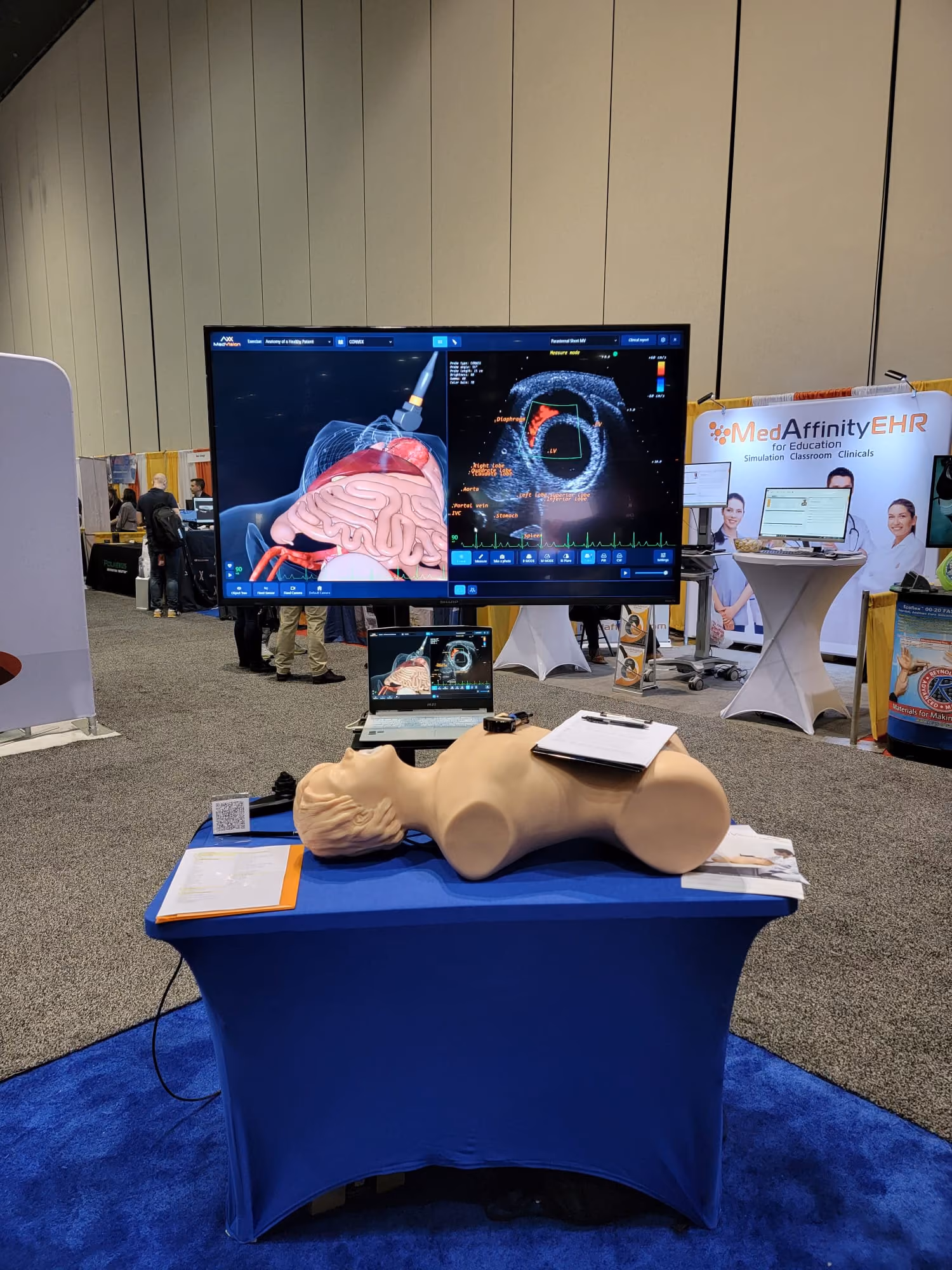 SonoVision Ultrasound Simulation