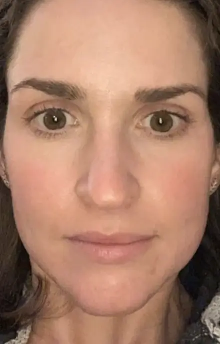 photo of individual after tox