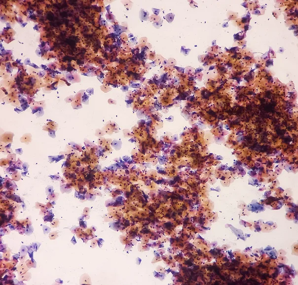 Scattered brown and purple particles on cream-colored background.