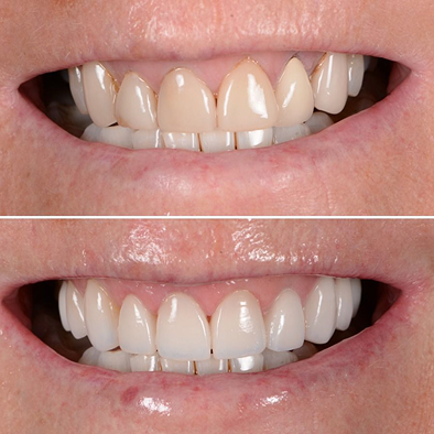 Paulton Dental & Implant Centre