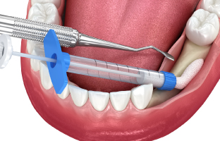 Paulton Dental & Implant Centre