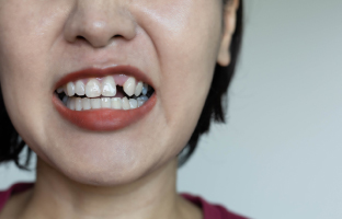 Paulton Dental & Implant Centre