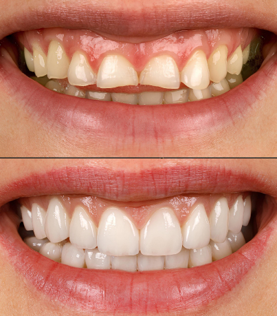 Paulton Dental & Implant Centre