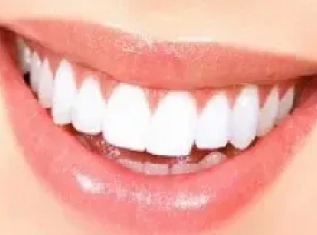 Perfect Smile Studio - Smile Makeover