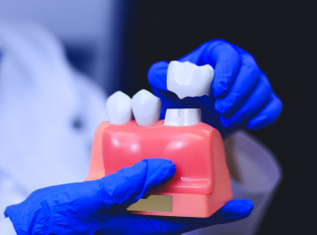 FREE Invisalign® I Dr. Gujit S Randhawa