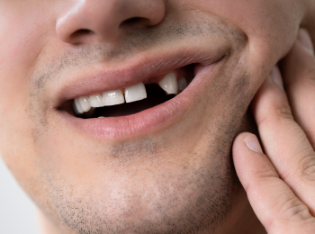 FREE Invisalign® I Dr. Gujit S Randhawa