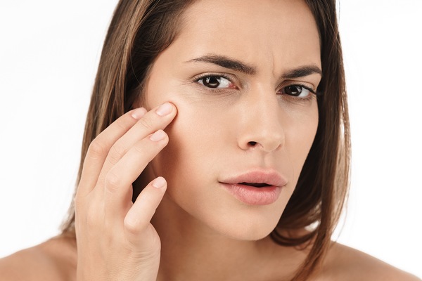 Dark circles and bags are signs of aging skin.