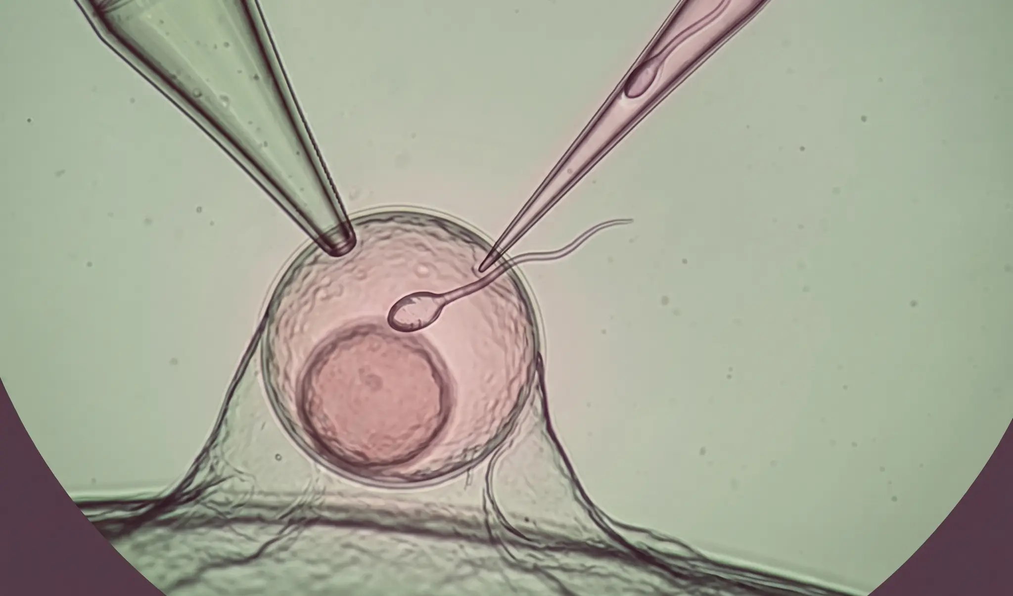 inseminacion artificial
