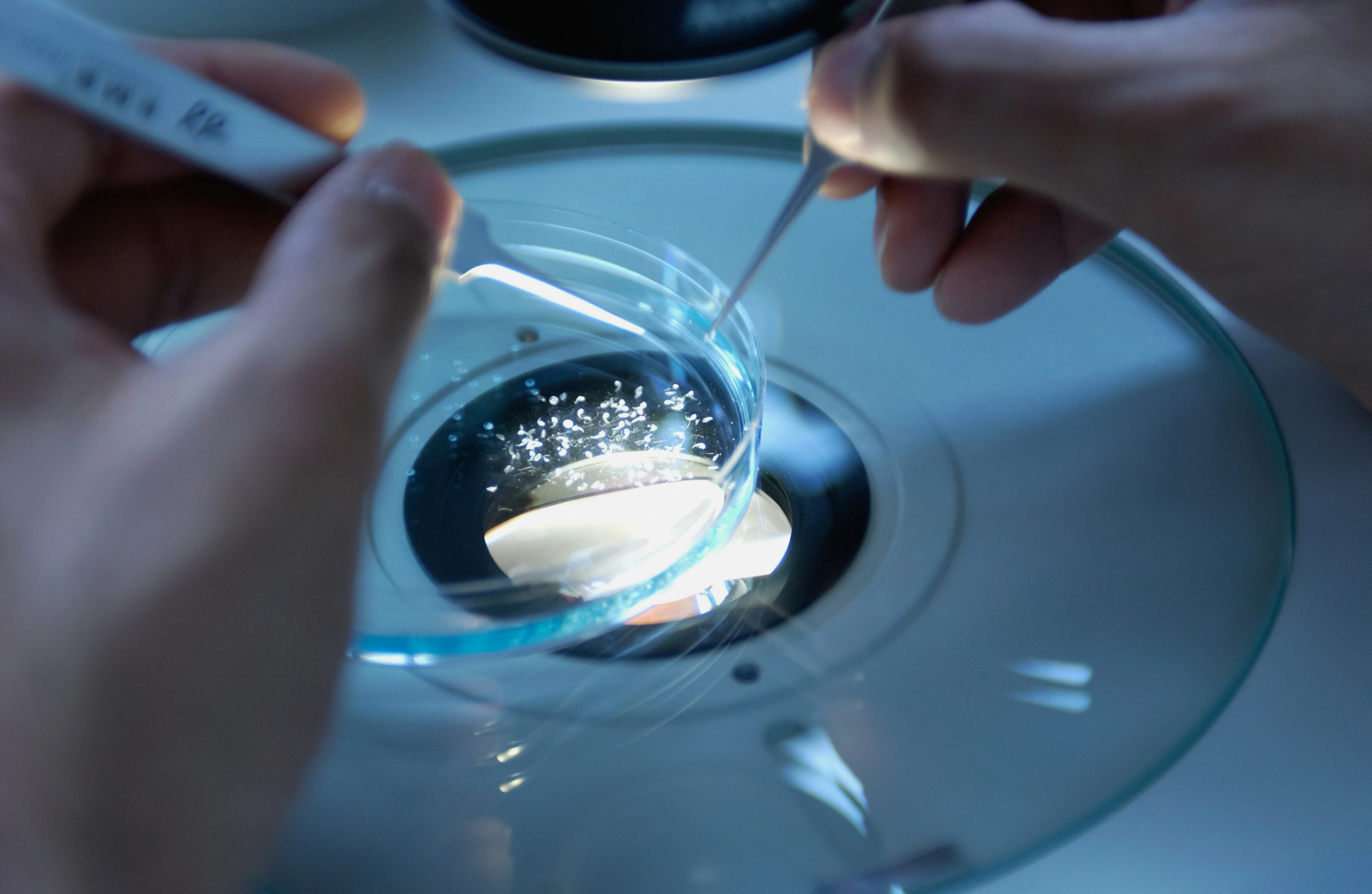 Laboratorio de Avida Fertility para el procesamiento de muestras de esperma