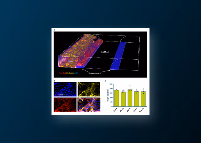 Investigating the Hallmarks of Inflammatory Bowel Disease (IBD) in a 3D Perfused Multicellular Intestine-on-a-Chip Model