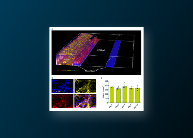 Investigating the Hallmarks of Inflammatory Bowel Disease (IBD) in a 3D Perfused Multicellular Intestine-on-a-Chip Model