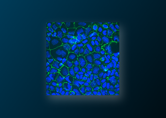 7 Ways Caco-2 Cells Can Make or Break Your Intestinal Permeability Models