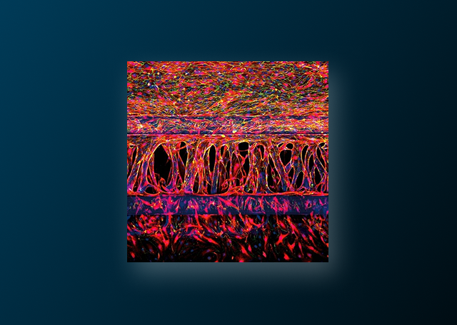 Dissatisfied With Your Angiogenesis Model? Read This