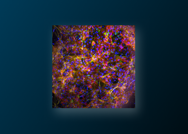 The Beginner’s Guide to ECM Gels