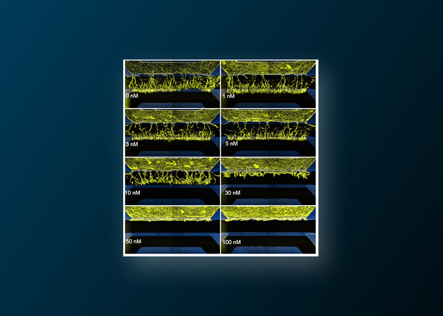 Tumor-Stroma-Macrophage Interaction