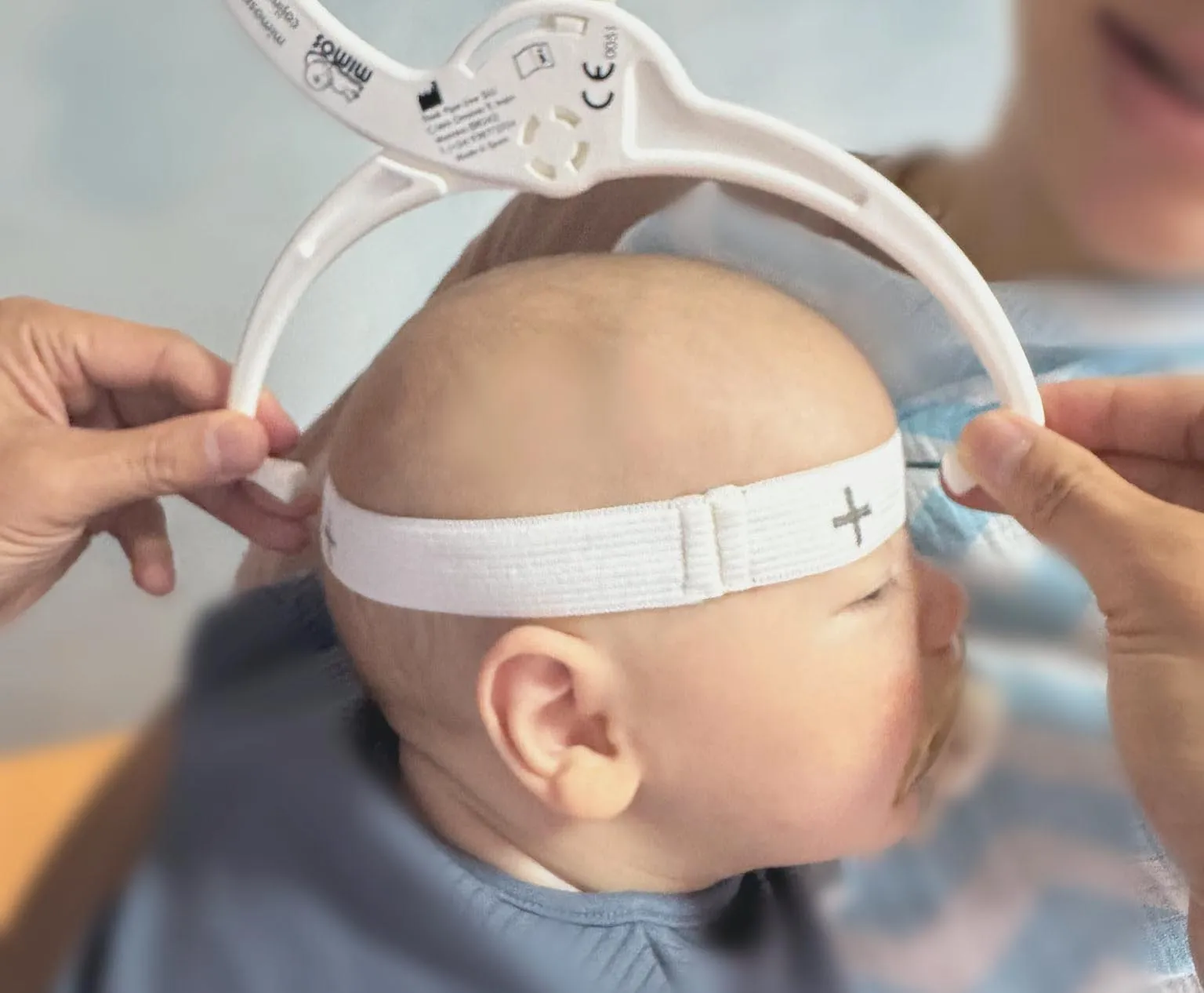 Baby receiving Happy Melons Program treatment at City Osteopathy using specialized cranial remolding helmet for flat head syndrome correction, demonstrating the clinic's advanced osteopathic care for newborns and postural asymmetry treatment