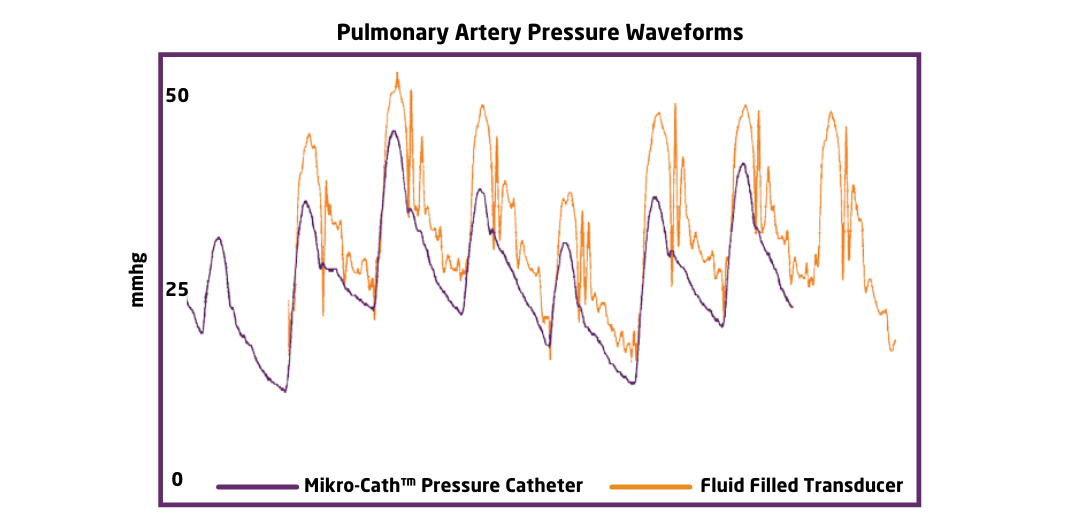 Pulmonary artery pressure waveforms graph with purple and orange lines representing Millar's Mikro-Cath Pressure Catheter versus a Fluid Filled Transducer in mmhg.