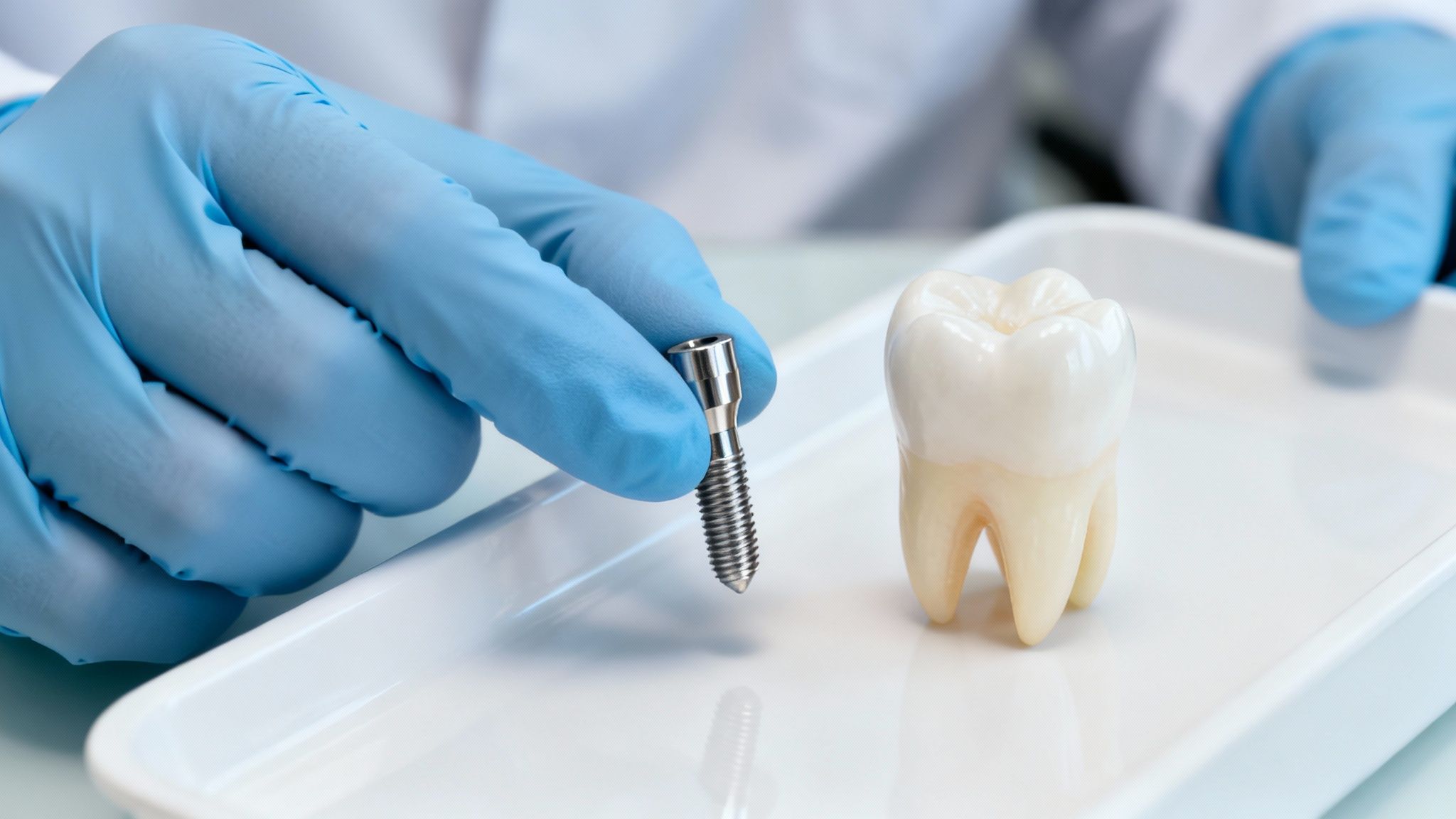 A gloved dentist's hand holds a shiny dental implant next to a realistic tooth model.