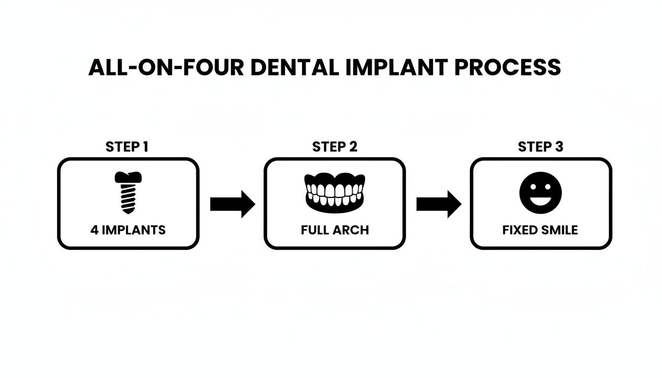 Infographic showing the three-step all-on-four dental implant process: 4 implants, full arch, and fixed smile.