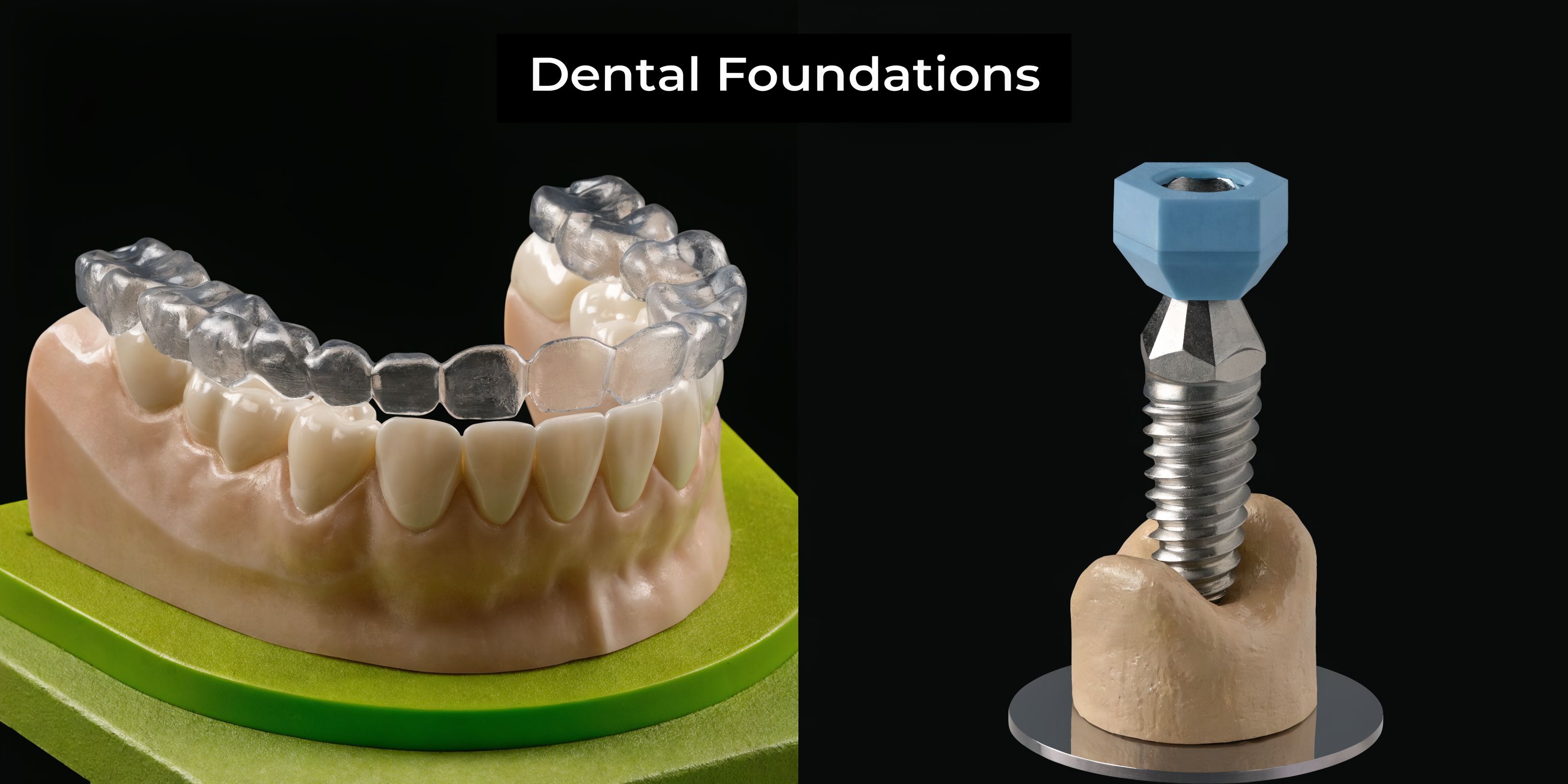 A split screen image showing a clear dental aligner on a model and a titanium dental implant.
