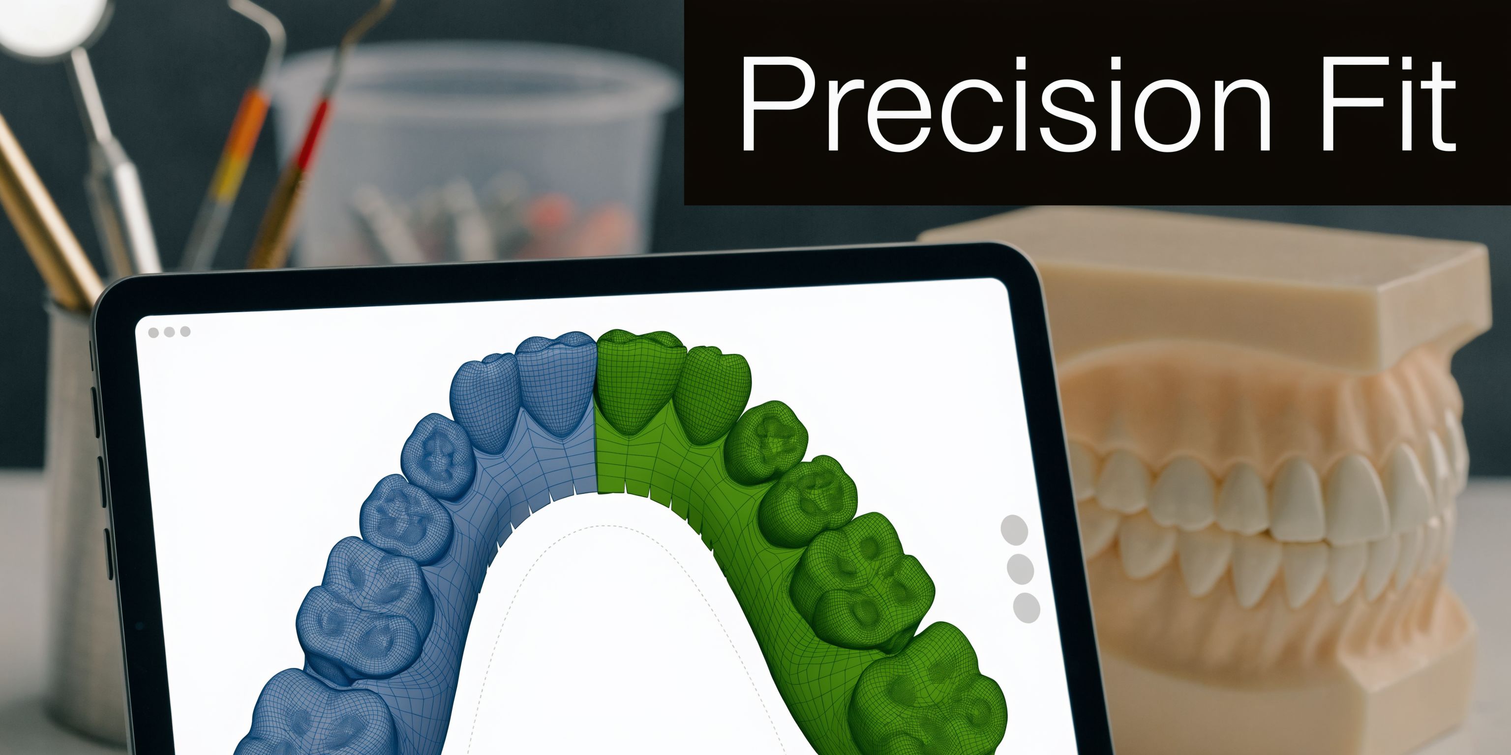 A digital tablet displaying a 3D dental model next to a physical dental impression model.