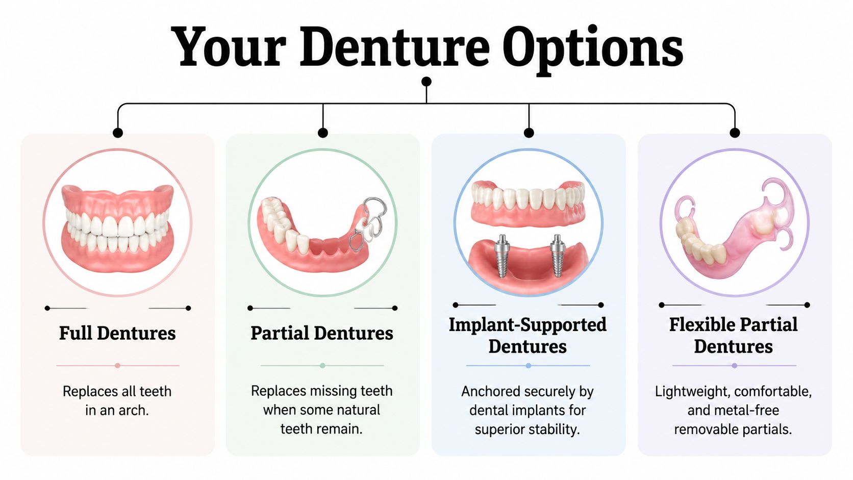 An educational infographic displaying four common types of dentures: full, partial, implant-supported, and flexible partial dentures.