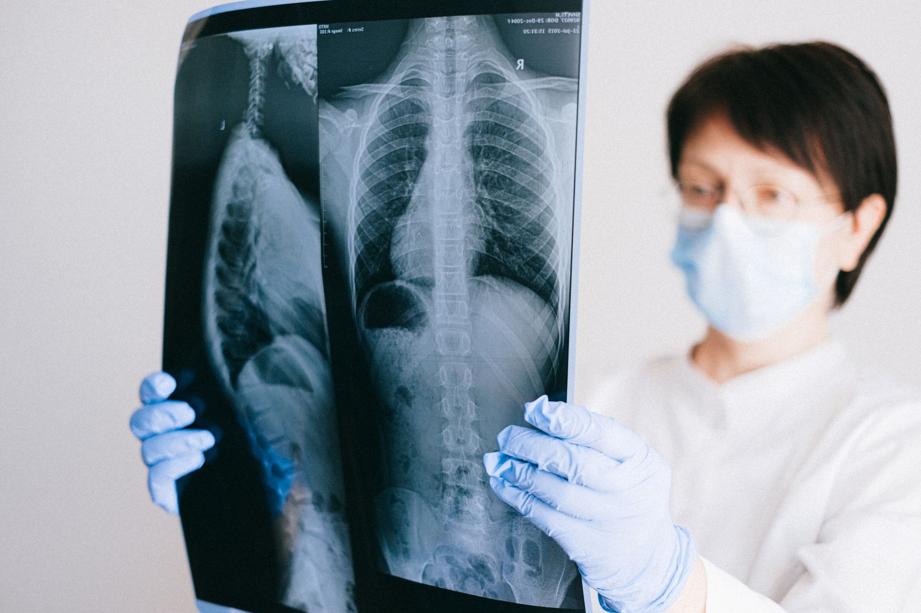 A medical professional analyzes a chest x-ray wearing gloves and a mask in a clinical setting — Longevity & Healthspan