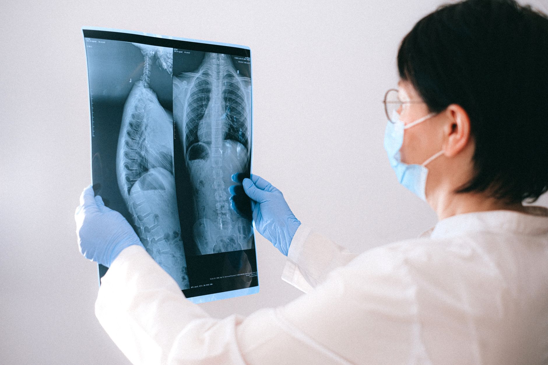 Medical professional in mask and gloves examining a chest X-ray indoors — Preventive Medicine