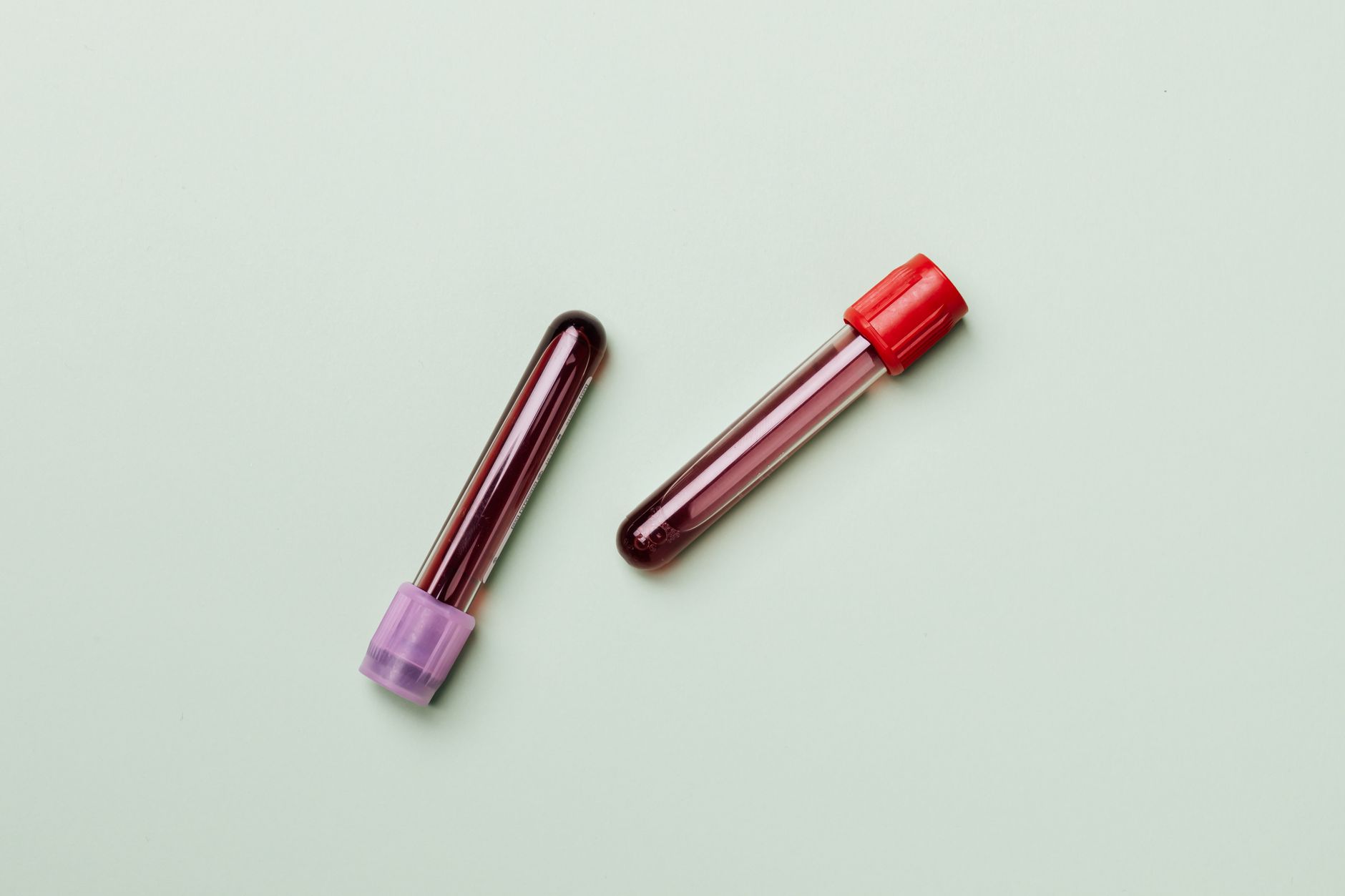 Blood samples in test tubes on a light background, ideal for medical and laboratory themes — Preventive Medicine