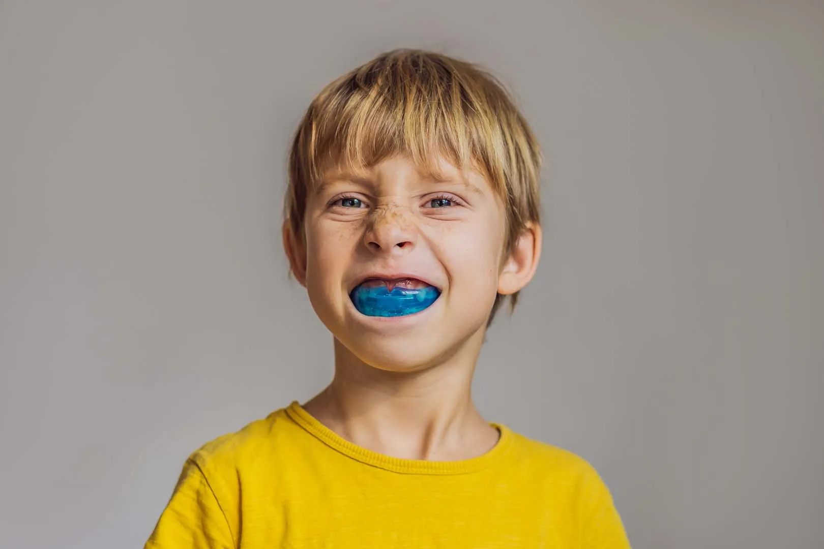Occlusal & Sports Mouthguards