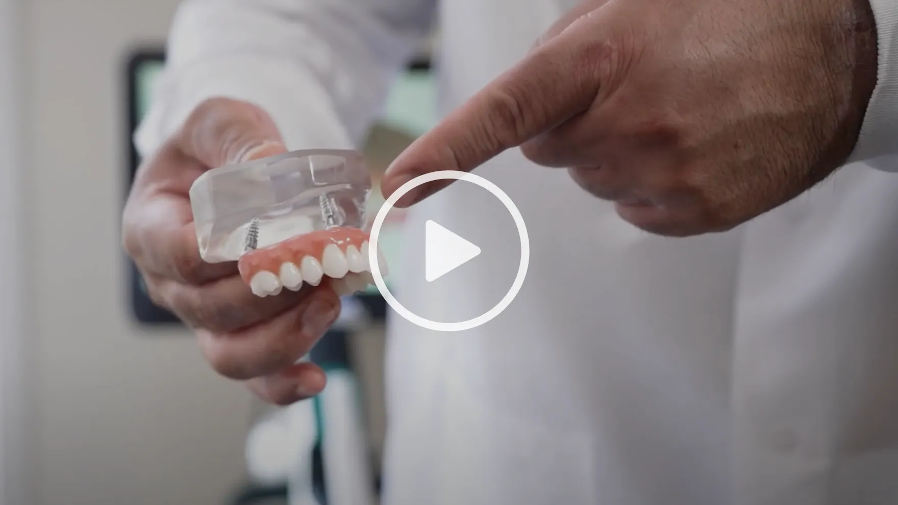 Full Mouth Replacement FAQ