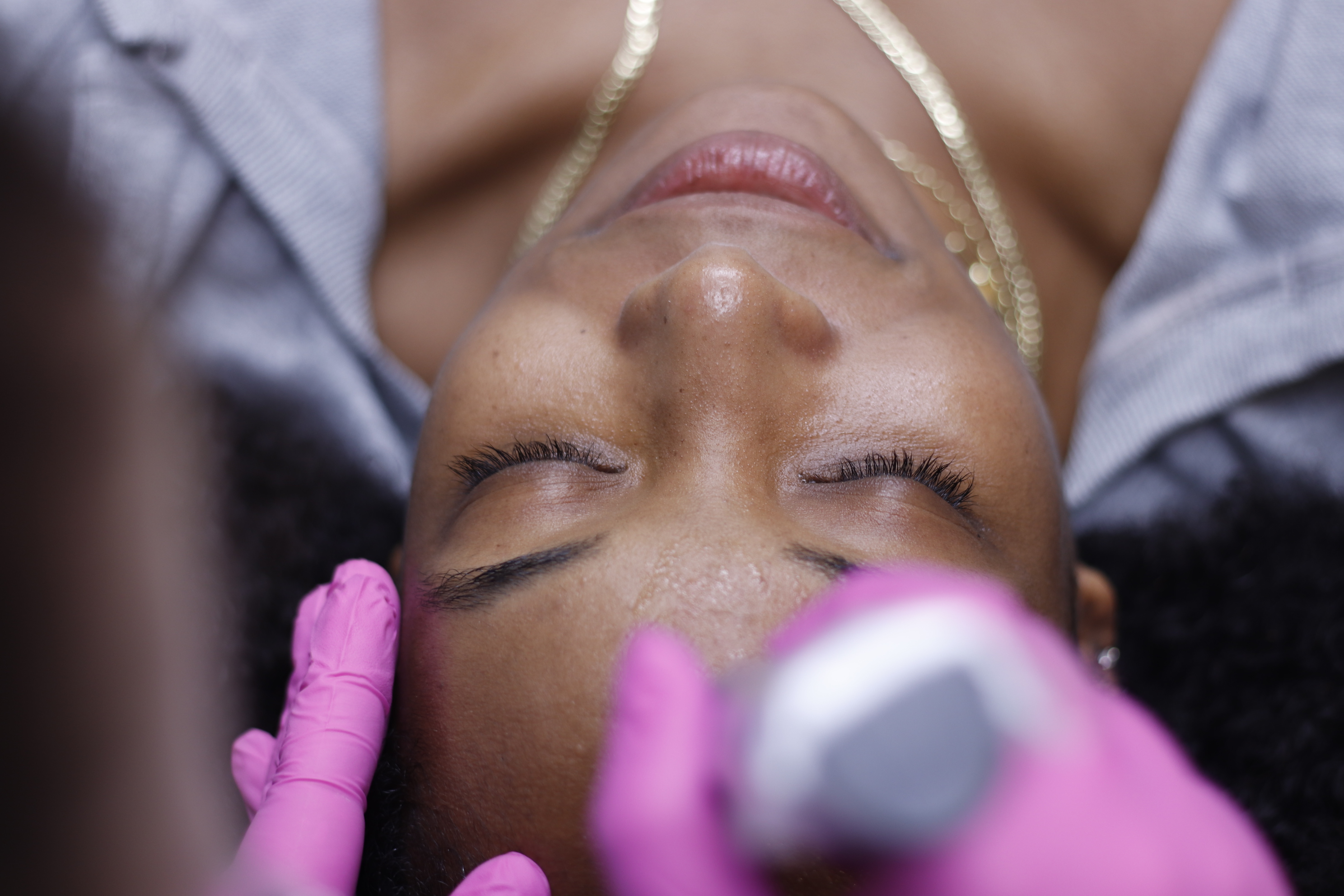 Biote bioidentical hormone optimization pellet therapy at Admire Medical Aesthetics